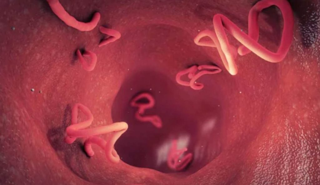 Parassiti intestinali: basta questa spezia ogni giorno che ti aiuta ad eliminarli per sempre
